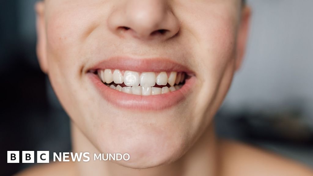 Alimentos que ayudan a cuidar las bacterias saludables de tu boca
